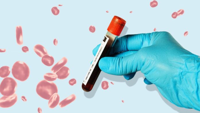 Groundbreaking Blood Test Galleri Detects 50+ Cancers Early, Study Shows