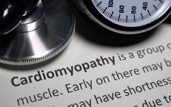 Simple Blood Test May Help Predict Risk In Patients With Hypertrophic Cardiomyopathy, Study Finds