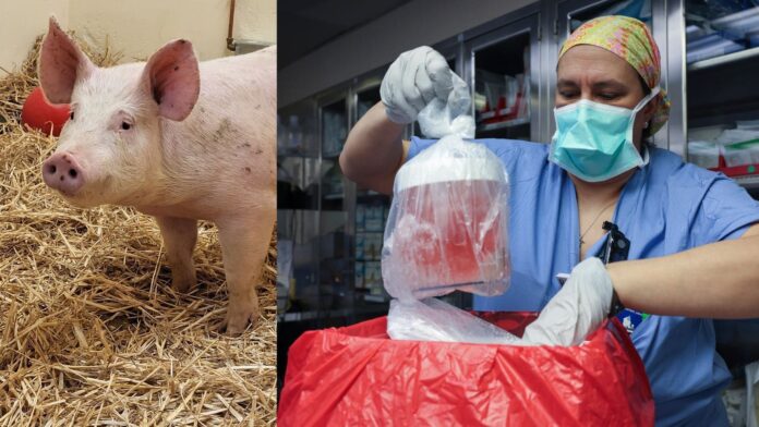 Pig Organ Transplants May One Day Surpass Human Donor Organs, Say US Researchers