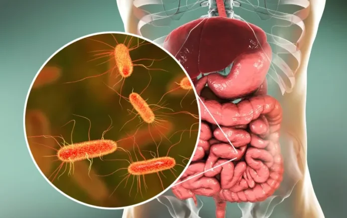 SIBO Symptoms Explained: Nutritionist Rashi Chowdhary Highlights Warning Signs And Diet Tips For Better Gut Health