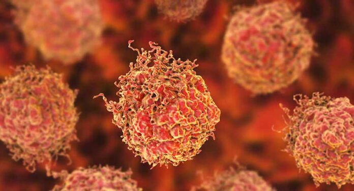 India’s Cancer Cases Up 10%, Deaths Up 29% In A Decade: Government Data Reveals Alarming Trend