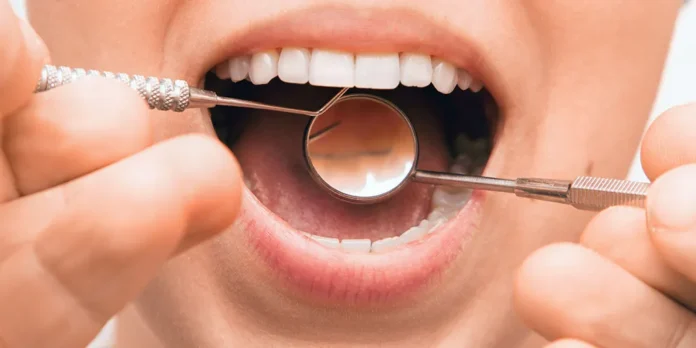 Healthy Teeth May Be Key To Longer Life, Large Japanese Study Suggests