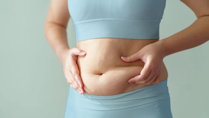 What Is Cortisol Belly? How To Identify Stress-Related Belly Fat And Reduce It Naturally