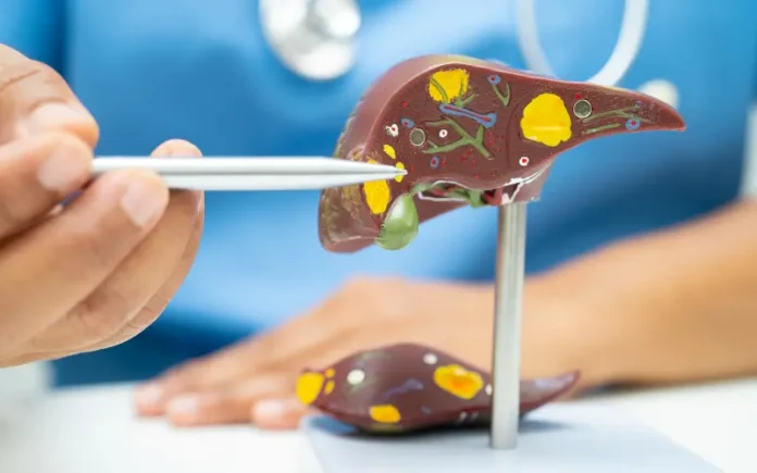 Fatty Liver Is Not Just About Sugar: Expert Warns Oil And Lifestyle Habits Are Major Hidden Causes